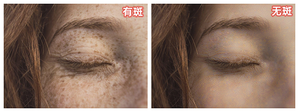 雀斑 - 副本.jpg